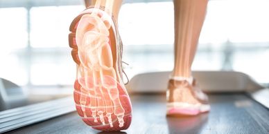 Plantar fasciitis and Achilles