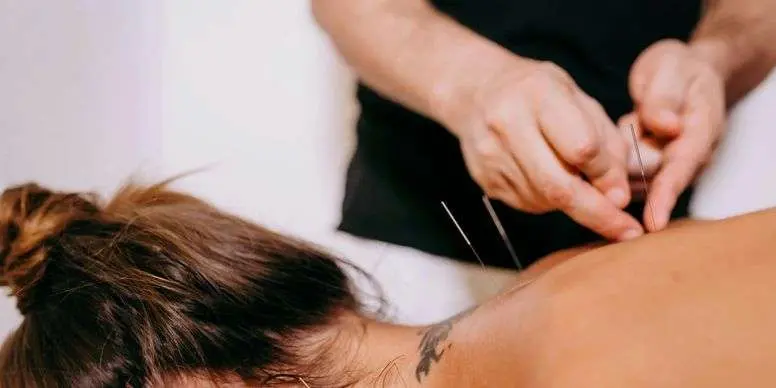 Western-Acupuncture-and-Dry-Needling Western-Acupuncture-and-Dry-Needling